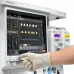 Mindray WATO EX-65 Pro Vet Ветеринарный наркозно-дыхательный аппарат